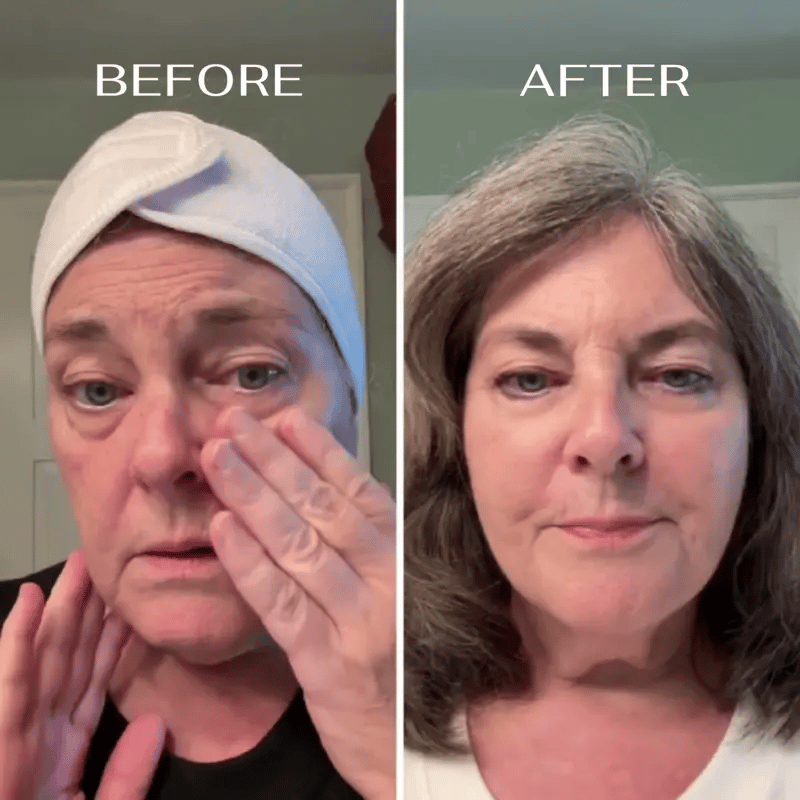 Vrouw brengt EyeRenewal oogbalsem aan