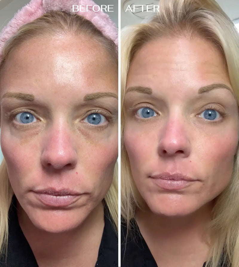Gebruiker van EyeRenewal oogbalsem
