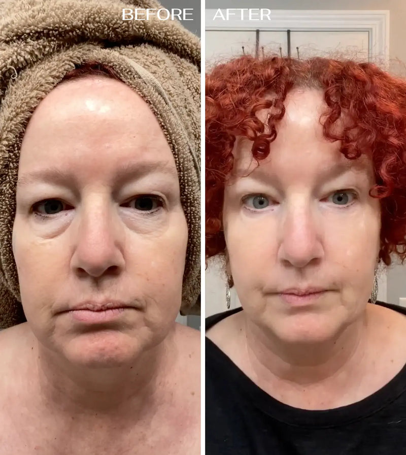 Gebruiker van EyeRenewal oogbalsem