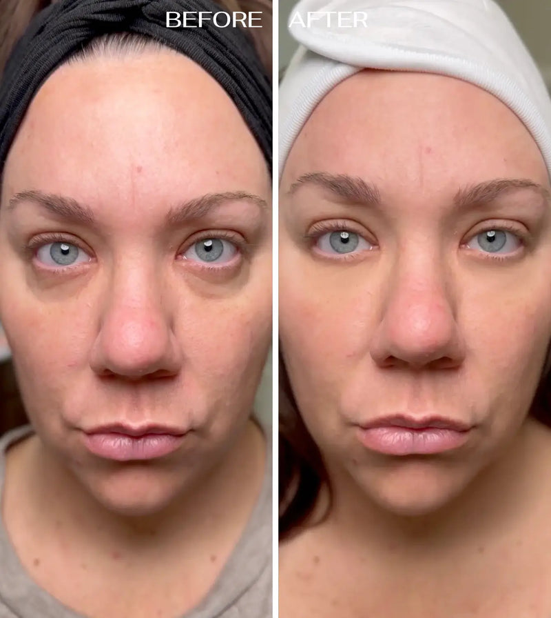 Gebruiker van EyeRenewal oogbalsem